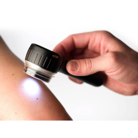 Dermlite DL4 dermatoscope with  PigmentBoost @ Plus 