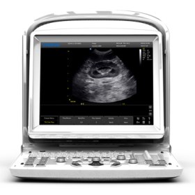 CHISON ECO 3 expert LED B&W COMPACT PORTABLE ULTRASOUND SYSTEM - 