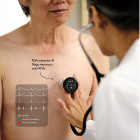 Eko CORE 500™ Digital Stethoscope