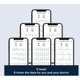 Portable Pocket ECG KardiaMobile 6L
