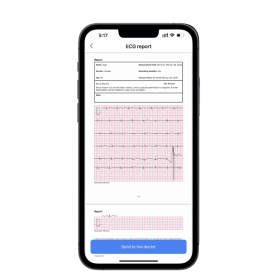 Καρδιογράφος τσέπης φορητός DUOEK S ER2