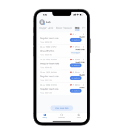Καρδιογράφος τσέπης φορητός DUOEK S ER2