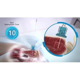 Συσκευή ενδοοστικής έγχυσης παίδων NIO-P - 