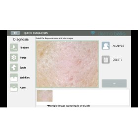 Portable professional Skin analyzer DS VISO