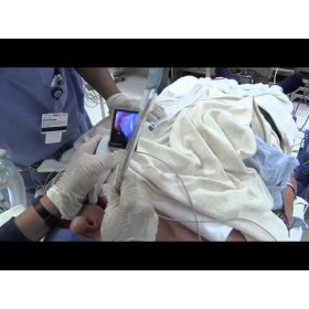 McGrath MAC video laryngoscope - 