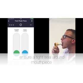 MIR Smart One Spirometer and Peak flow meter