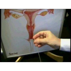 Insemination catheter Ainswhite R.IMOS. - 