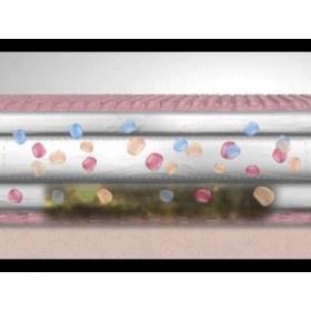 Αντικολλητικά επιθέματα τραχειοστομίας Allevyn Tracheotomy 9x9cm 10 τεμάχια 7640 - 