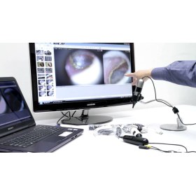 Earscope pro Video Otoscope Dinolite MEDL4EP