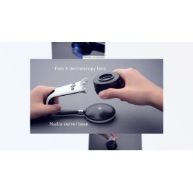Συσκευή δερματοσκόπησης νυχιών και καπιλαροσκόπησης DermLite Nailio®