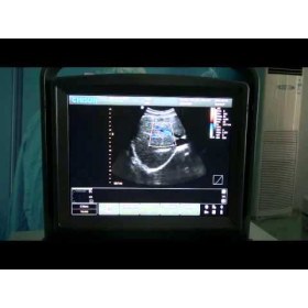 Chison ECO3 Portable Color Ultrasound - 