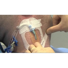 Waterproof medical dressing Tegaderm | CHG with chlorexidine 8.5x11.5cm (1 piece) - 