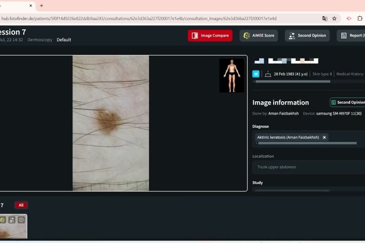 Youtube zEJ8w8uzyH4