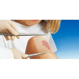 Grassolind parafin gauze dressing 10 x 10cm 10pcs - 