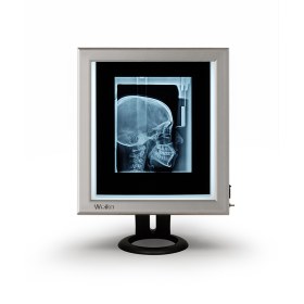 Διαφανοσκόπιο επιτραπέζιο μονό WEIKO SLIM LED 