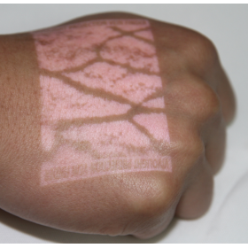 Συσκευή απεικόνισης φλεβών Υπερύθρων V800F