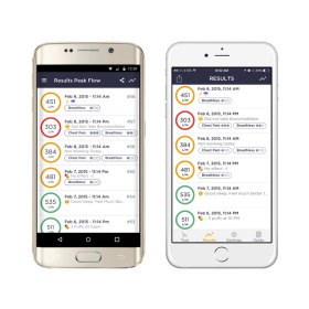MIR Smart One Spirometer and Peak flow meter