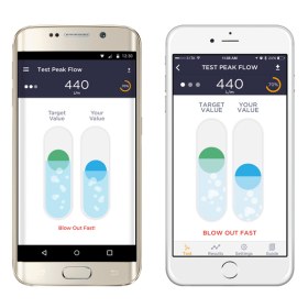 MIR Smart One Spirometer and Peak flow meter