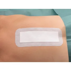 SAFEPORE Absorbent adhesive sterile pads 100pcs (10cm wide) | 10x15cm - 