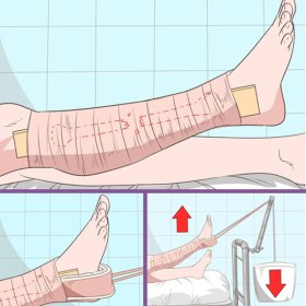 Skin traction kit DELUXE  - 