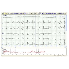 Holter ρυθμού 12 απαγωγών TLC5000 Contec - 