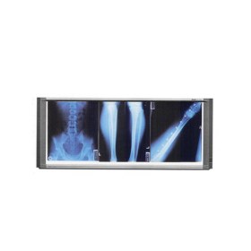 Slim LCD X-ray illumintor MST-4000III 3 panels