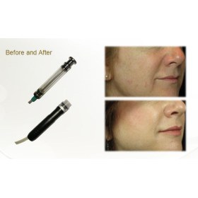 Diamond Microdermabrasion Machine & Water Hydra Facial Skin Treatment Machine 2 in 1 