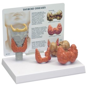 Model of Thyroid Diseases W33370