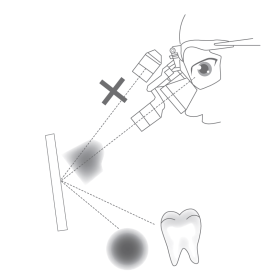 Σύστημα Μετωπιαίου Φωτισμού LED ασύρματο για Χειρουργικές λούπες 
