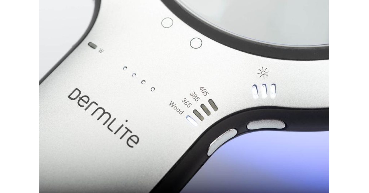 Dermlite Lumio®2 Magnifying Light Dermatoscope LED | Δίγκας Γ. Ιατρικά