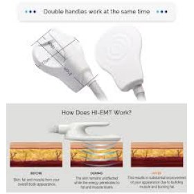 Μηχάνημα αδυνατίσματος και αύξησης μυϊκής μάζας EMS Sculpt