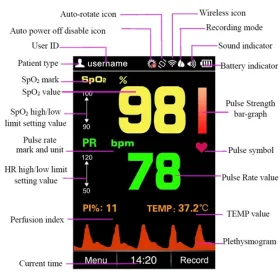 Neonate handheld Oximeter SP-20 