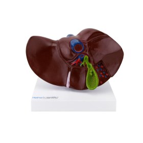 Model of a gallbladder with gallstones H139056