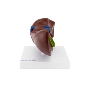 Model of a gallbladder with gallstones H139056 - 