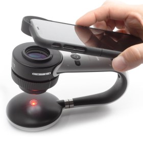 Συσκευή δερματοσκόπησης νυχιών και καπιλαροσκόπησης DermLite Nailio®