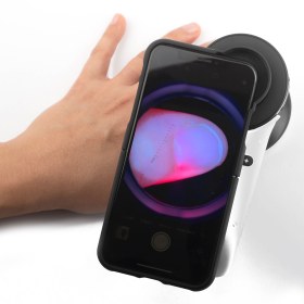 Συσκευή δερματοσκόπησης νυχιών και καπιλαροσκόπησης DermLite Nailio®