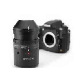 Σύστημα δερματοσκόπησης DermLite Foto II Pro