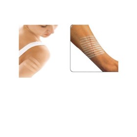 3M Steri-Strip skin closure (Reinforced) 50 pieces | 12x100mm Blue - 3M Steri-Strip skin closure (Reinforced) 12mm x 100mm 1pc 1547 