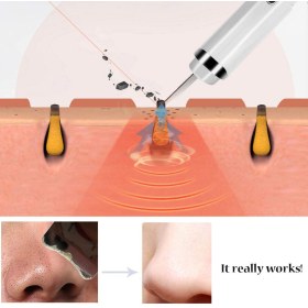 Φορητή συσκευή απόξεσης και απολέπισης  δέρματος 3 σε 1 BF1209