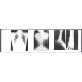 Διαφανοσκόπιο Slim LCD MST-4000IV τετραπλό