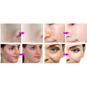 Multifunction facial cleanser 6 in 1 Hydrogen-Oxygen LB439