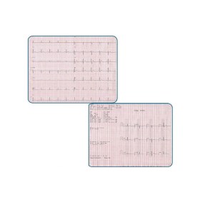 Καρδιογράφος Smart ECG SE-12 Express Edan - Καρδιογράφος Smart ECG