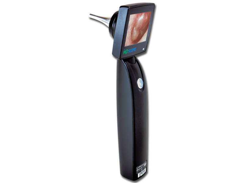 Video otoscope MD Scope Elite Pack Video otoscope MD Scope Elite Pack