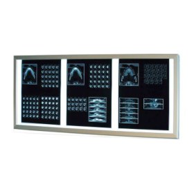 Διαφανοσκόπιο επιτοίχιο τριπλό WEIKO SLIM LED  - 