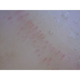 CapillaryScope DINOLITE PRO 200 MEDL4N - Dinolite Capillaroscope 200 pro MEDL4N