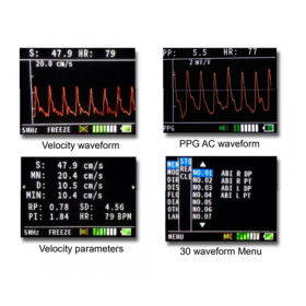 Doppler Bidop 7 Hadeco  - 