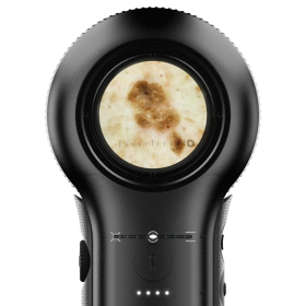 Δερματοσκόπιο Dermlite DL5