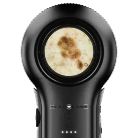 Δερματοσκόπιο Dermlite DL5