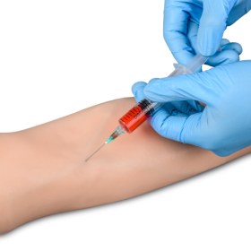 Multi Venous IV Practice Adult Arm and Hand Kit - 