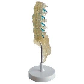 Πρόπλασμα σπονδυλικής στήλης 131610 - 